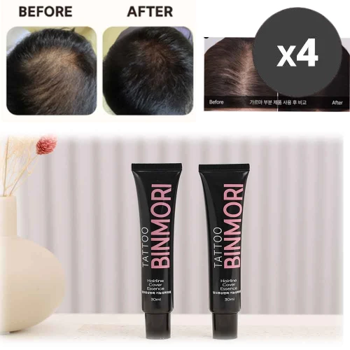 빈머리 커버왕 헤어타투 에센스 30ml x 4개 (탈모증상완화 기능성)(업체별도 무료배송)